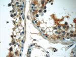 BAALC Antibody in Immunohistochemistry (Paraffin) (IHC (P))