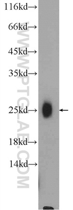 BAALC Antibody in Western Blot (WB)