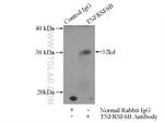 TNFRSF6B Antibody in Immunoprecipitation (IP)