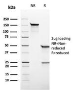 Alkaline Phosphatase (Placental)/PLAP (Germ Cell Tumor Marker) Antibody in Immunoelectrophoresis (IE)