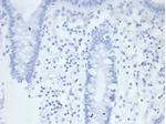 Alkaline Phosphatase (Placental)/PLAP (Germ Cell Tumor Marker) Antibody in Immunohistochemistry (Paraffin) (IHC (P))