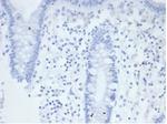 Alkaline Phosphatase (Placental)/PLAP (Germ Cell Tumor Marker) Antibody in Immunohistochemistry (Paraffin) (IHC (P))