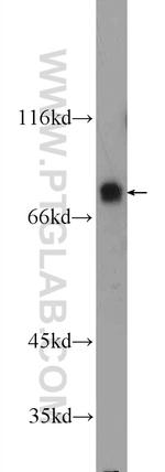 SP2 Antibody in Western Blot (WB)