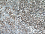 HCLS1 Antibody in Immunohistochemistry (Paraffin) (IHC (P))