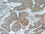 FGFBP1 Antibody in Immunohistochemistry (Paraffin) (IHC (P))