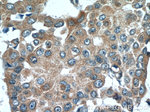 FGFBP1 Antibody in Immunohistochemistry (Paraffin) (IHC (P))