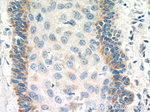 FGFBP1 Antibody in Immunohistochemistry (Paraffin) (IHC (P))