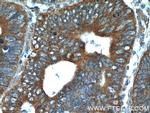 FGFBP1 Antibody in Immunohistochemistry (Paraffin) (IHC (P))