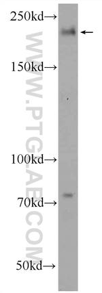 GCP6 Antibody in Western Blot (WB)