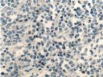 MSC Antibody in Immunohistochemistry (Paraffin) (IHC (P))