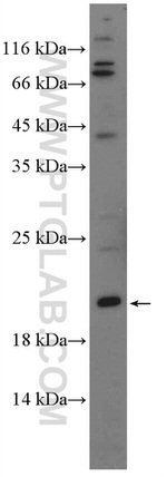 MSC Antibody in Western Blot (WB)