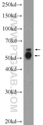 PAG1 Antibody in Western Blot (WB)