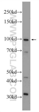 CCDC40 Antibody in Western Blot (WB)