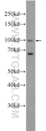 CCDC40 Antibody in Western Blot (WB)