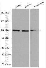 C19orf57 Antibody in Western Blot (WB)