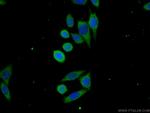 C19orf57 Antibody in Immunocytochemistry (ICC/IF)