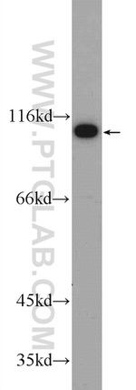 C19orf57 Antibody in Western Blot (WB)