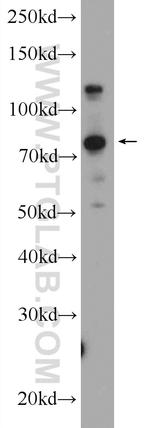 KIAA1530 Antibody in Western Blot (WB)