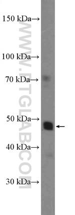 NR1H4 Antibody in Western Blot (WB)