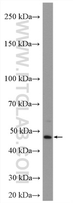 NR1H4 Antibody in Western Blot (WB)