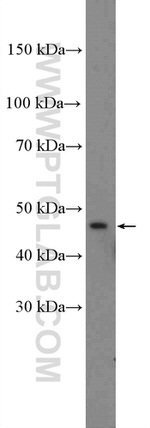 NR1H4 Antibody in Western Blot (WB)