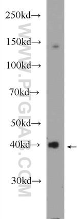 HAO1 Antibody in Western Blot (WB)