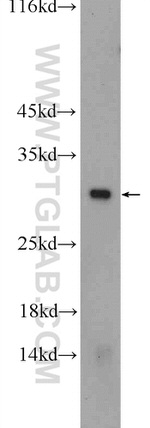 CAPNS1 Antibody in Western Blot (WB)
