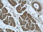 DDX58 Antibody in Immunohistochemistry (Paraffin) (IHC (P))