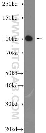 DDX58 Antibody in Western Blot (WB)