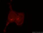 GPR107 Antibody in Immunocytochemistry (ICC/IF)