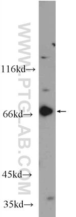 GPR107 Antibody in Western Blot (WB)