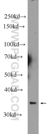 PGP Antibody in Western Blot (WB)