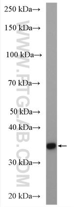 PGP Antibody in Western Blot (WB)