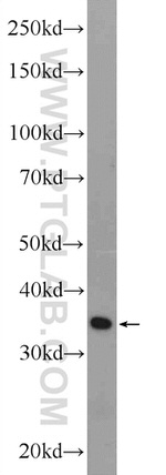 PGP Antibody in Western Blot (WB)