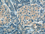 SIPA1L1 Antibody in Immunohistochemistry (Paraffin) (IHC (P))