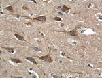 SIPA1L1 Antibody in Immunohistochemistry (Paraffin) (IHC (P))