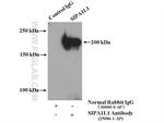 SIPA1L1 Antibody in Immunoprecipitation (IP)