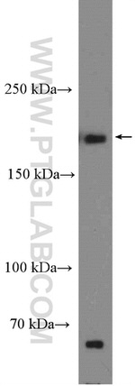 SIPA1L1 Antibody in Western Blot (WB)
