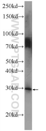 ODF3 Antibody in Western Blot (WB)