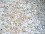 JMY Antibody in Immunohistochemistry (Paraffin) (IHC (P))