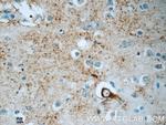 JMY Antibody in Immunohistochemistry (Paraffin) (IHC (P))