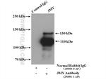 JMY Antibody in Immunoprecipitation (IP)