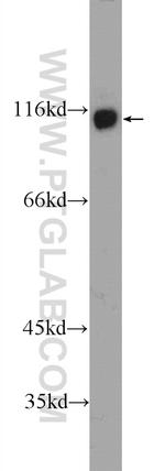 JMY Antibody in Western Blot (WB)