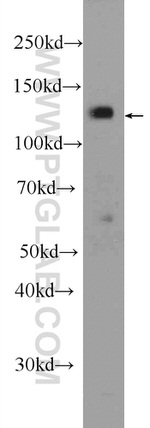 JMY Antibody in Western Blot (WB)