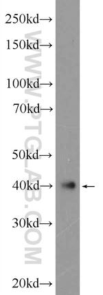 ATXN3L Antibody in Western Blot (WB)