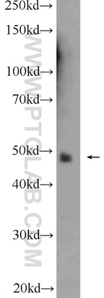 ATXN3L Antibody in Western Blot (WB)