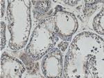 HIPK3 Antibody in Immunohistochemistry (Paraffin) (IHC (P))