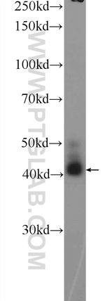 AWAT2 Antibody in Western Blot (WB)