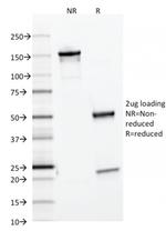 Ferritin, Light Chain Antibody in SDS-PAGE (SDS-PAGE)