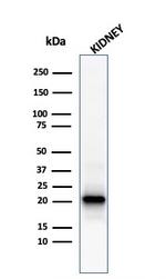 Ferritin, Light Chain Antibody in Western Blot (WB)